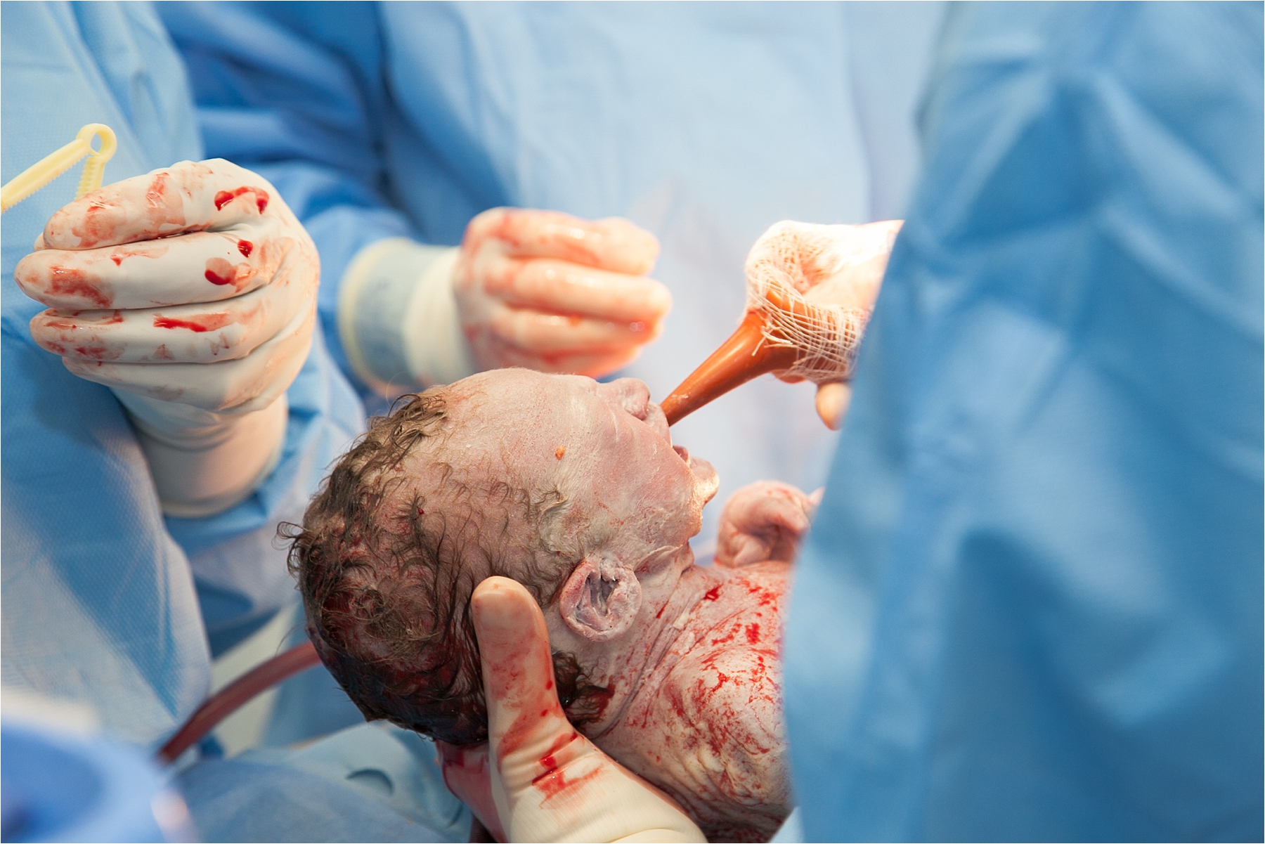 miami birth photographer
